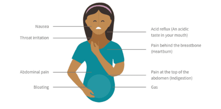 diagram of the causes of heartburn